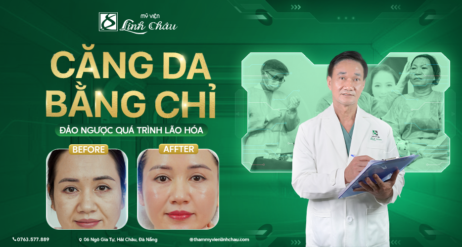 Dịch vụ căng da mặt bằng chỉ tại Mỹ viện Linh Châu Đà Nẵng