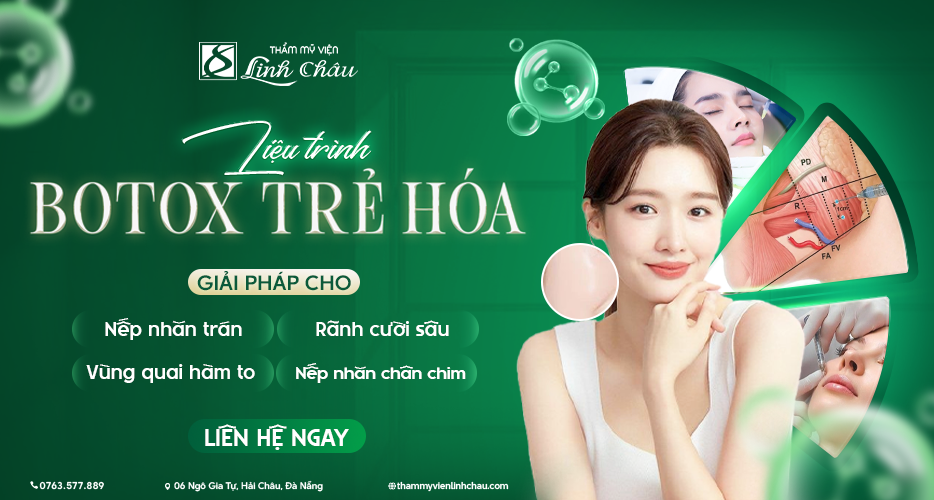 Liệu trình tiêm Botox trẻ hóa da tại TMV Linh Châu Đà Nẵng