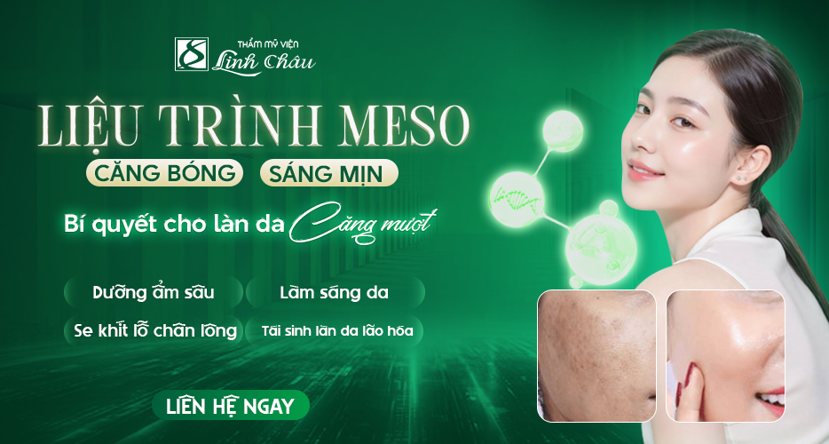 Dịch vụ tiêm Meso tại mỹ viện Linh Châu Đà Nẵng