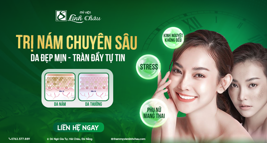 Dịch vụ Điều trị nám tại mỹ viện Linh Châu Đà Nẵng