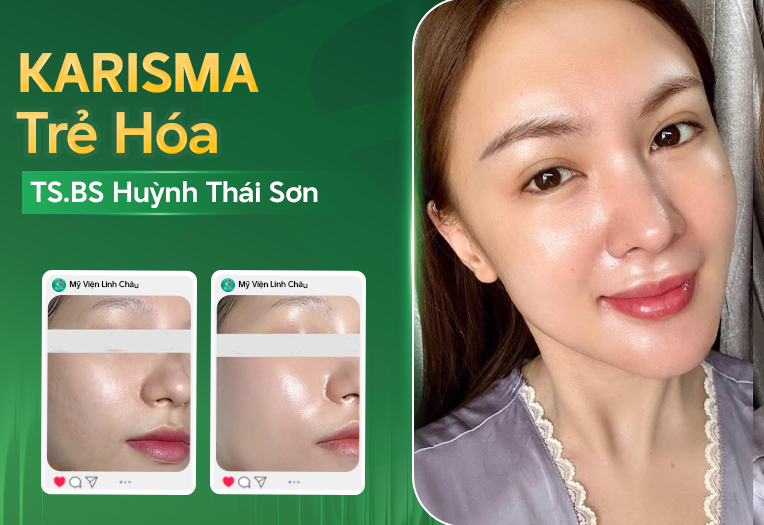 Trẻ hóa cấp ẩm – tái cấu trúc bằng Karisma RH Collagen