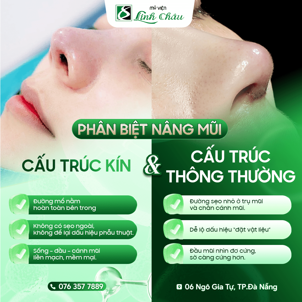 Cách làm mũi cao tự nhiên an toàn, hiệu quả - Giải pháp chuẩn y khoa được chuyên gia khuyên dùng