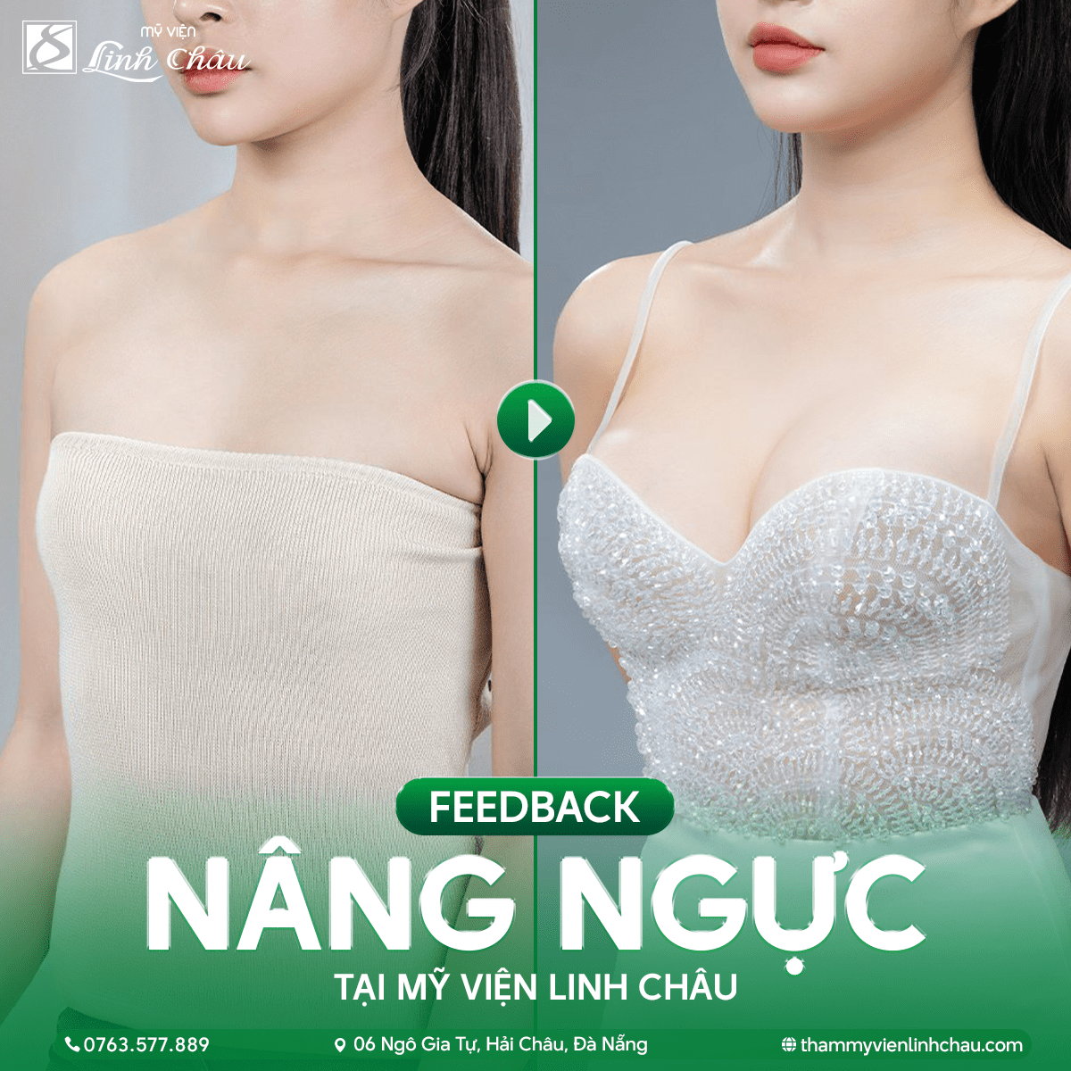 Liệu pháp thẩm mỹ không phẫu thuật – Bước trung gian an toàn